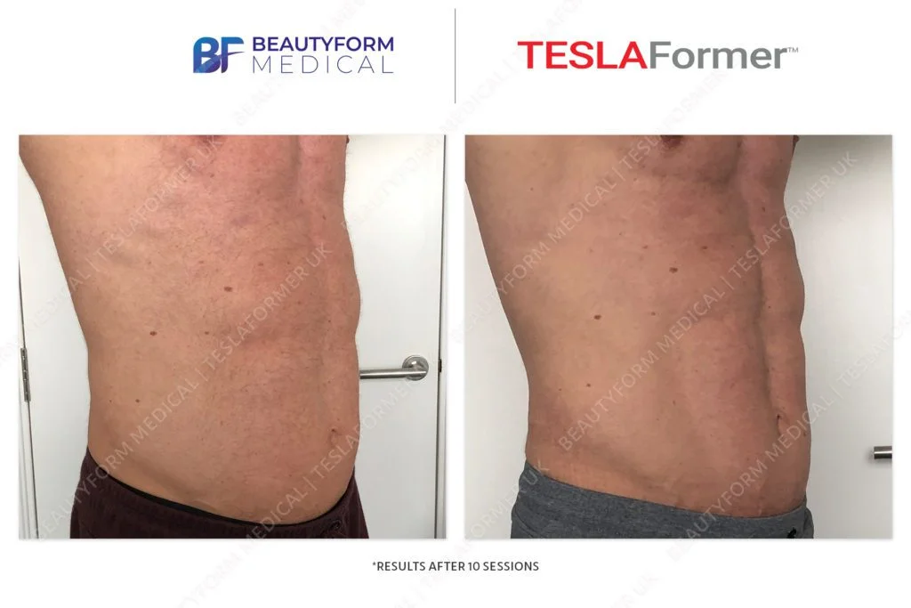 TeslaFormer-B&A-10sessions-45degree